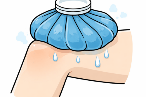 膝のアイシング